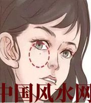 迪庆脸上这些地方有痣，不利财运，一生难发大财